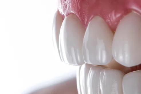前牙美學 1 anterior teeth aesthetics45245