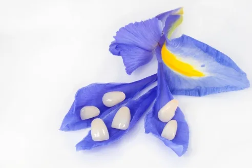 前牙美學 3 anterior teeth aesthetics743