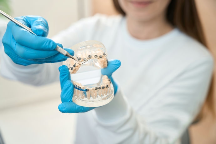 dentist hygienist holds model dentition with brace 2023 11 27 05 18 35 utc c