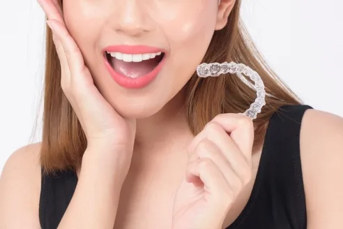 隱適美好嗎? 2 invisalign2572753 1