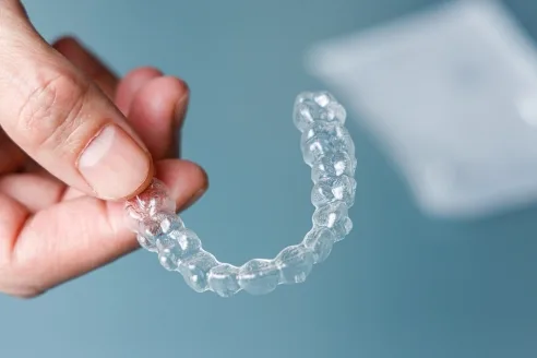 隱適美好嗎? 3 invisalign7252