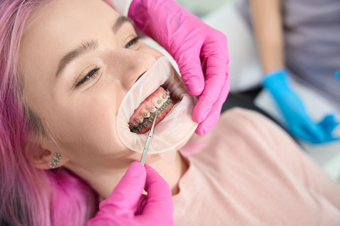 orthodontist checks the system for the correction 2023 11 27 05 05 27 utc c