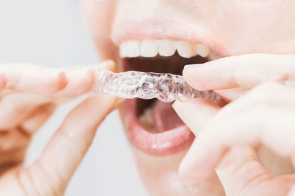 mouth-with-transparent-retainer-2023-11-27-04-51-16-utc_c